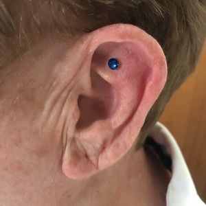 Stress Relief Blue Earring Magnet Acupressure Stress Relief